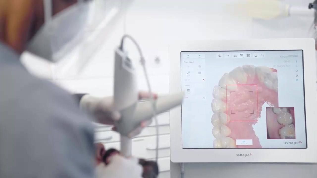 Digitaler 3D-Scan des Gebisses auf dem Monitor in der MALO CLINIC Prague