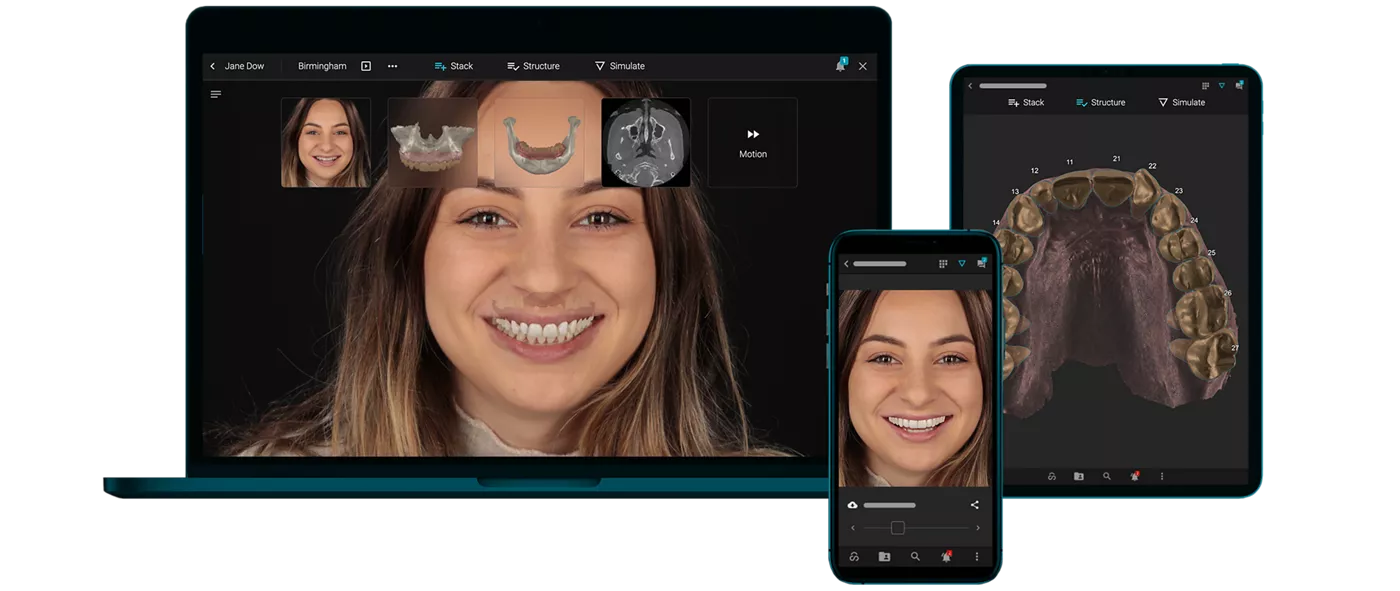 Example of the Smilecloud interface for smile design